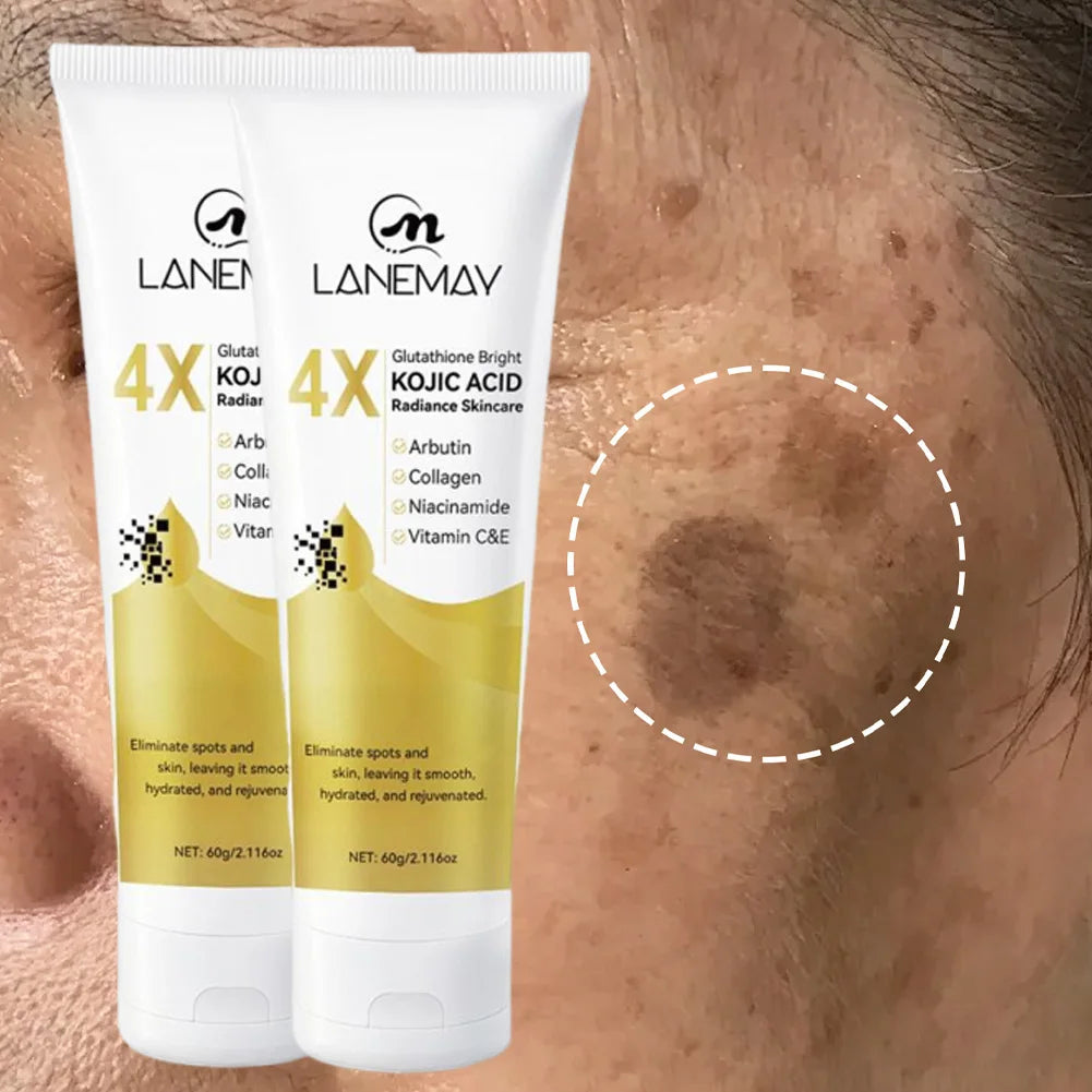 Kojic Acid Brightening Cream – Dark Spot & Even Skin Tone