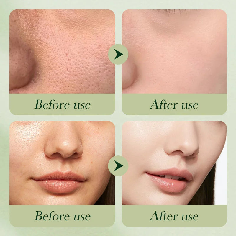 SADOER Avocado 6-Piece Skincare Set | Eye Cream & Anti-Wrinkle
