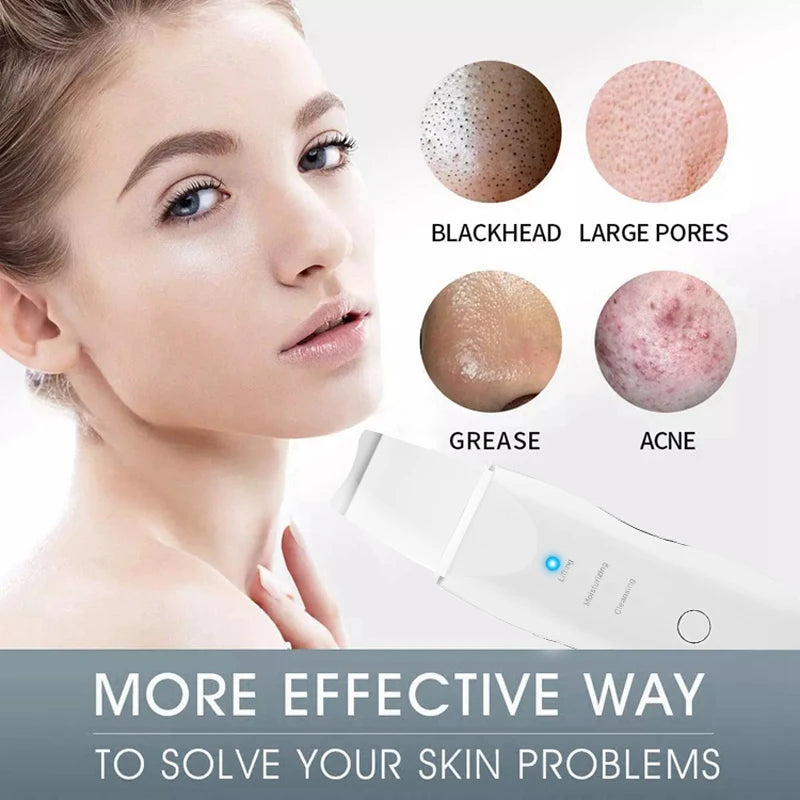 Ultrasonic Skin Facial Cleaner Blackhead Removal Pore Scrubber Face Scrubber with Peeling Feature Beauty & Personal Care Product Peaceful Pleasures Health and Wellness