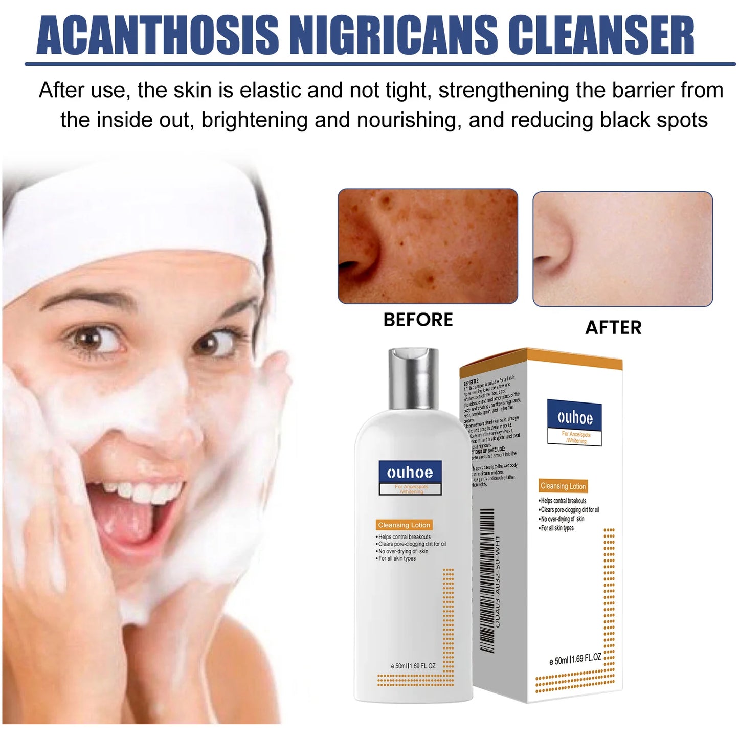 Brightening Face Wash – Acne, Dark Spots & Blackhead Remover