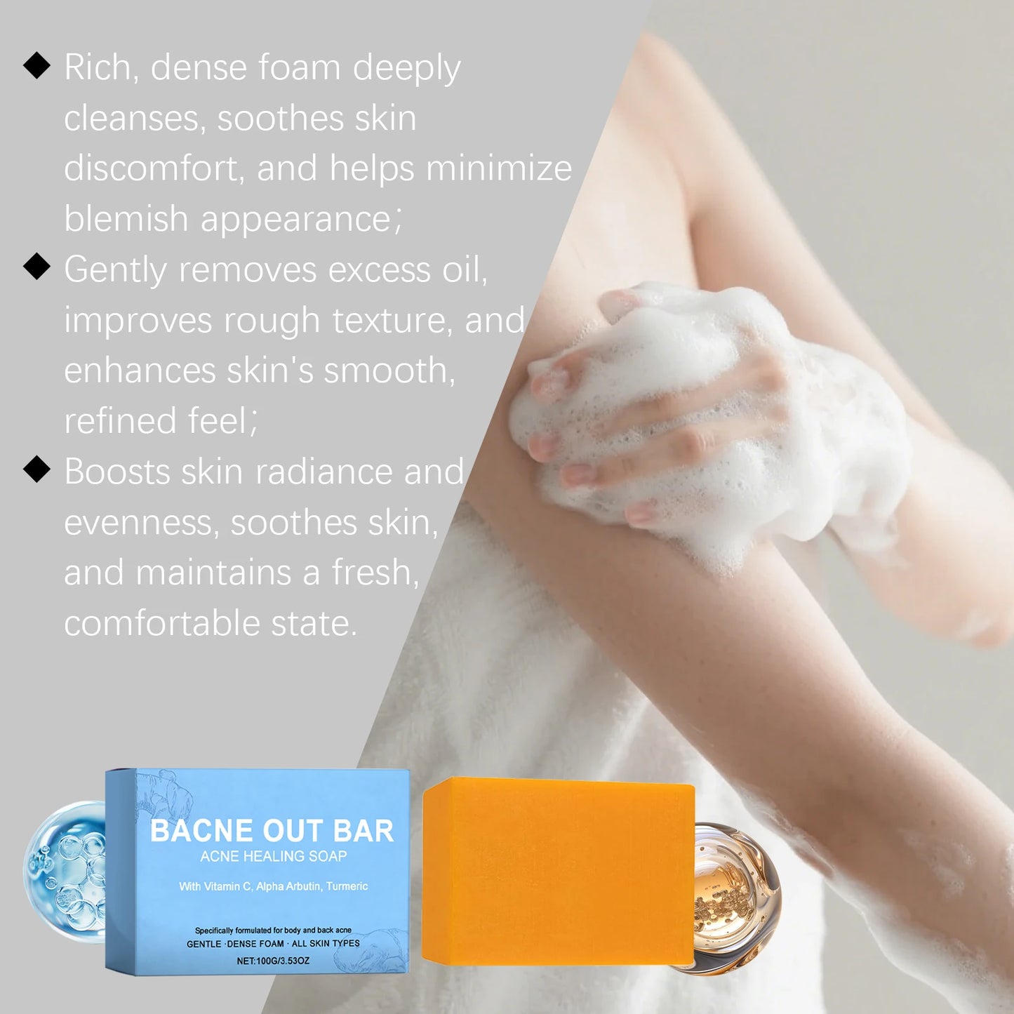 Peeling Repair Soap – Oil Control, Deep Cleanse & Skin Repair