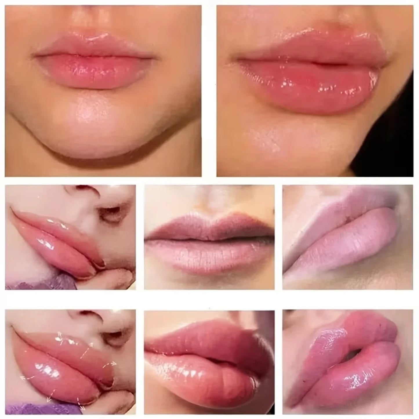 Lip Plumping Cream – 10X Extreme Volume & Ultra Hydrating