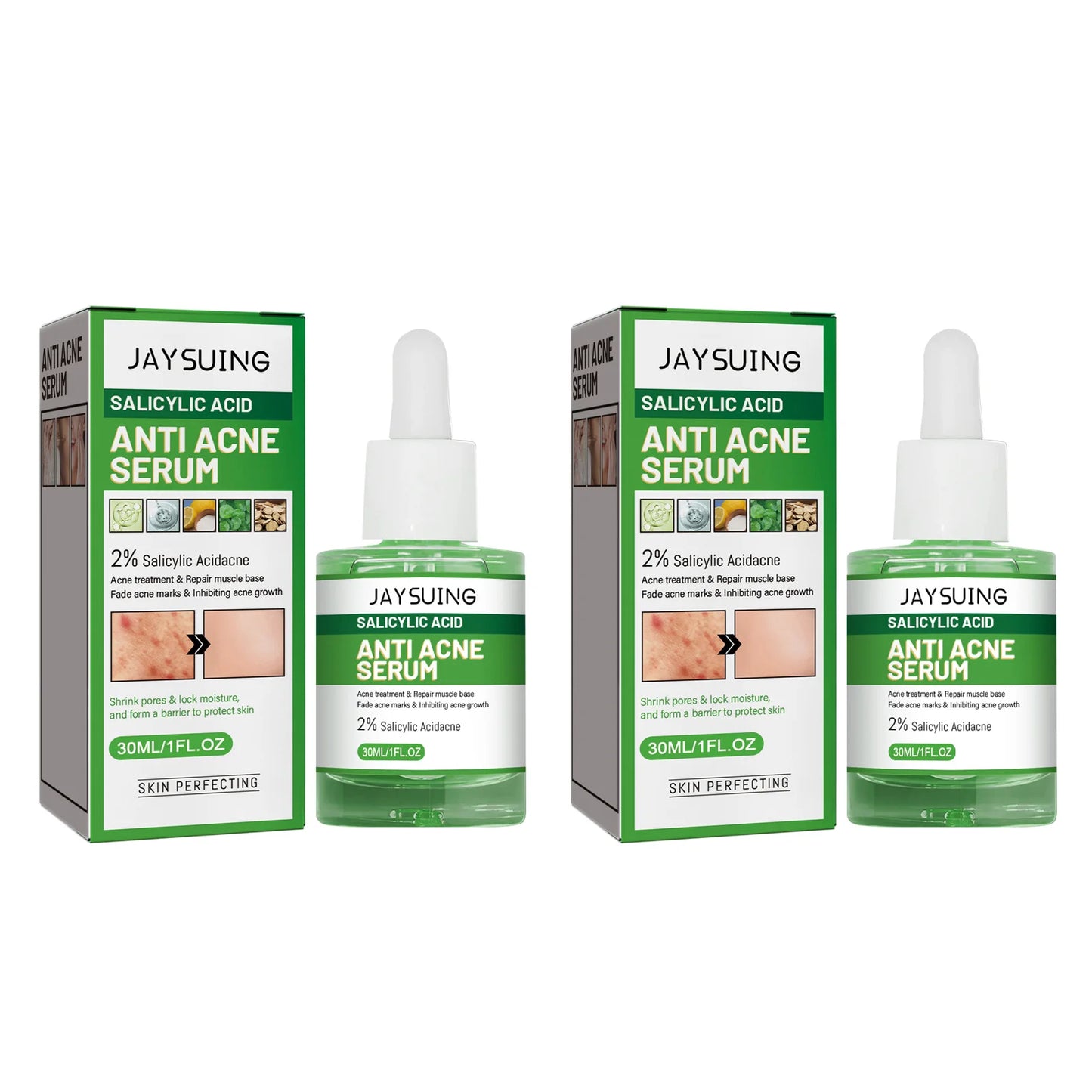 Salicylic Acid Acne Face Serum – Pores, Blackheads & Oil
