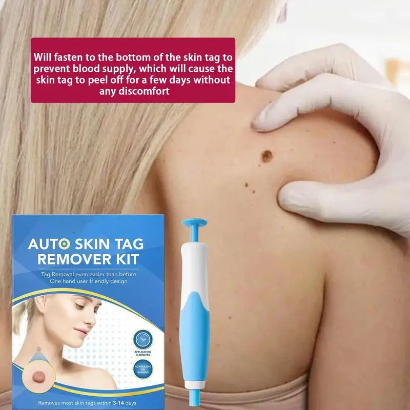 2-in-1 Skin Tag Removal Kit – Pen, Bands & Wipes | 2–8mm