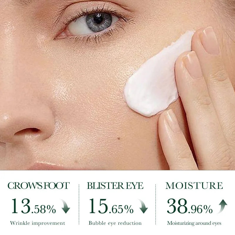 SADOER Tea Tree Acne Face Cream – Oil Control & Moisturizer