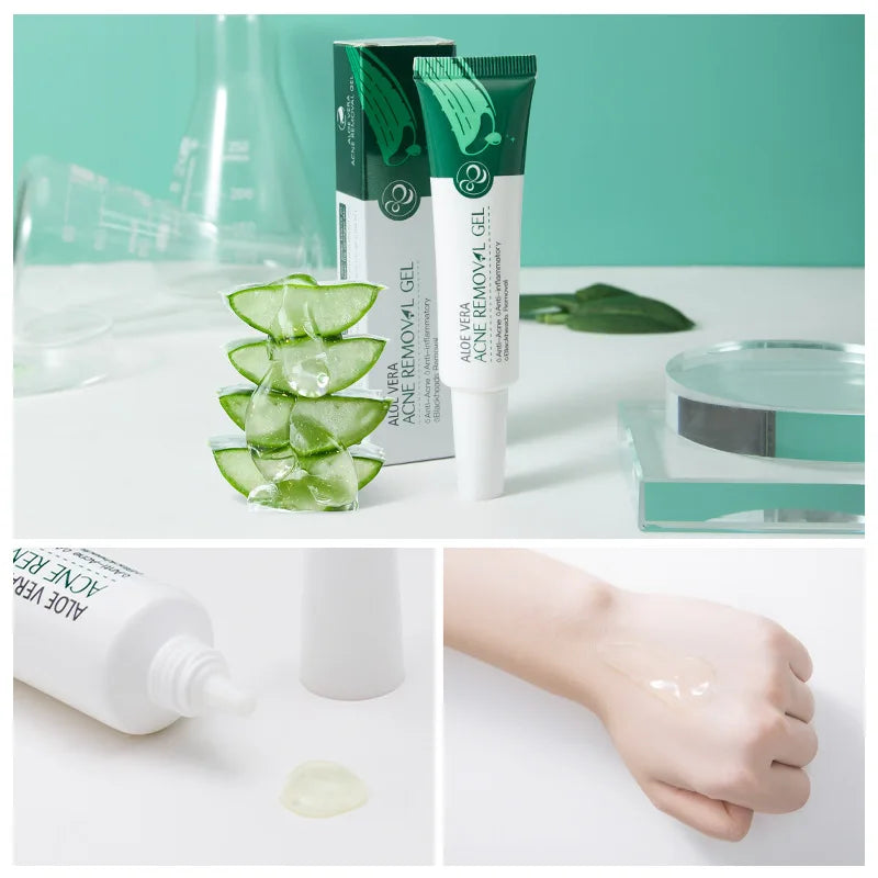 LAIKOU Aloe Vera & Tea Tree Moisturizing Facial Cream