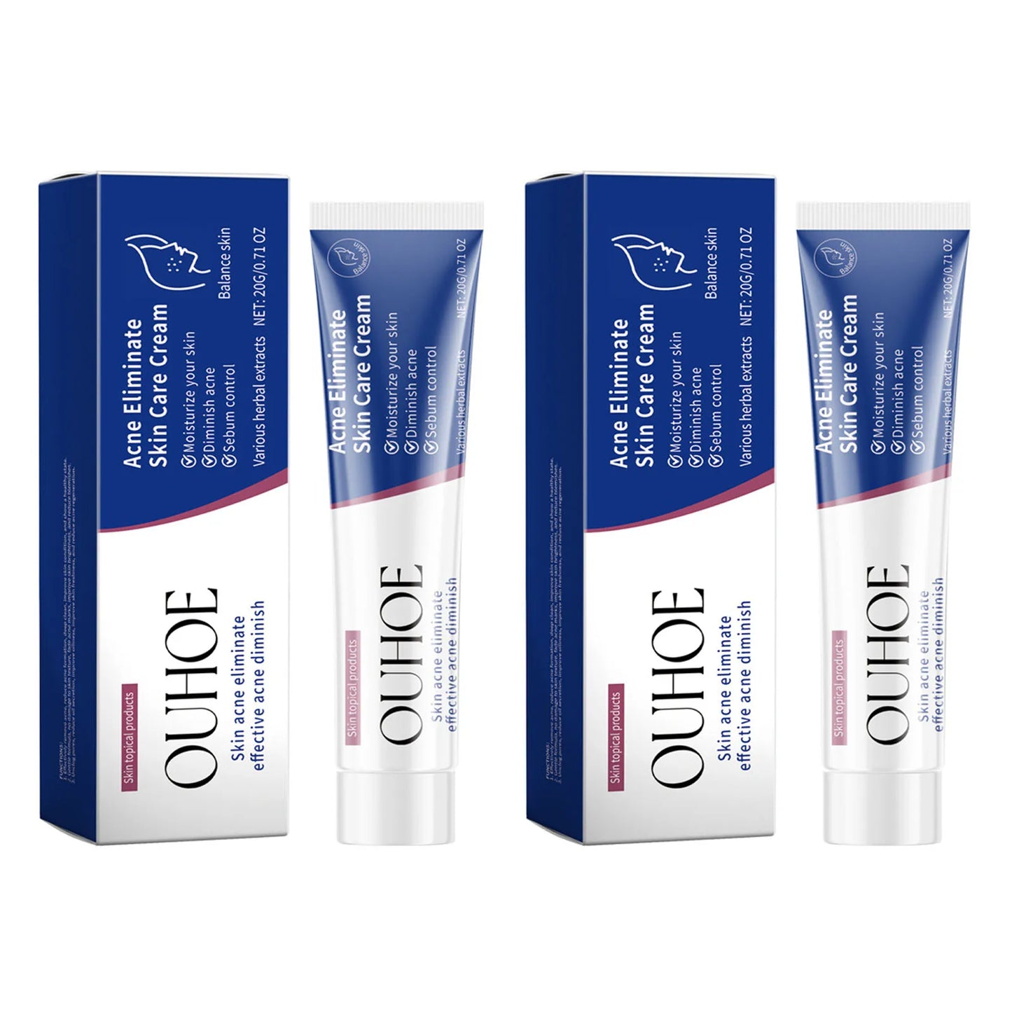 Herbal Acne Face Cream – Oil Control & Blemish Care 20g