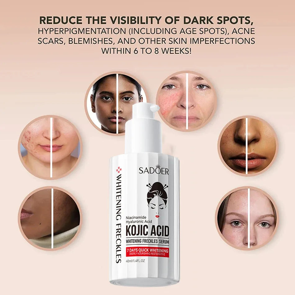 Kojic Acid Serum Strong Brightening Whitening Cream Spots Fine Lines Lighten Skin Tone Rejuvenating Antiage Korean Facial Peaceful Pleasures Health and Wellness