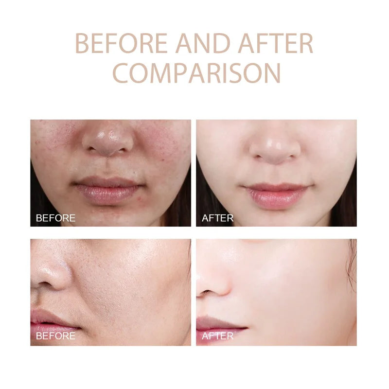 Exfoliating Gel Scrub – Face & Body Jelly Deep Clean Exfoliator