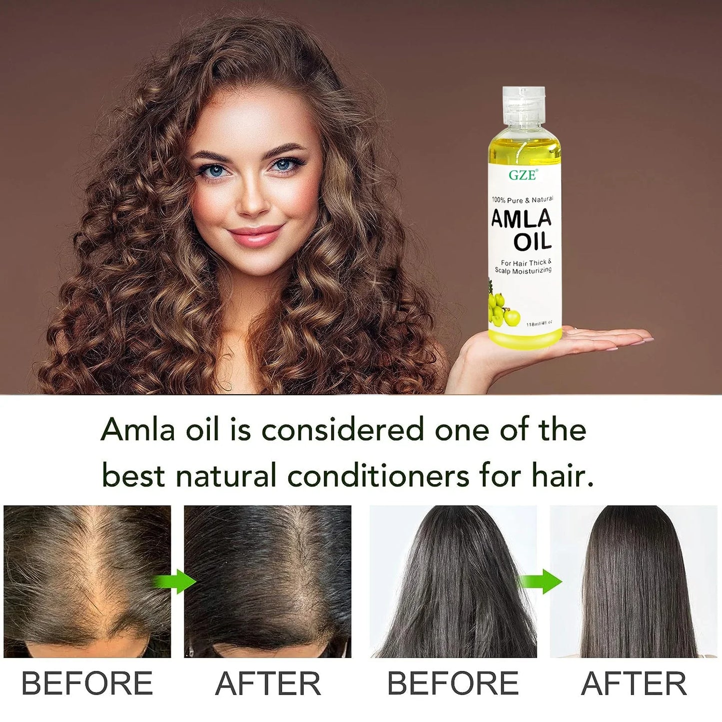 GZE Amla Hair Oil – Shine, Scalp Moisture & Healthy Hair
