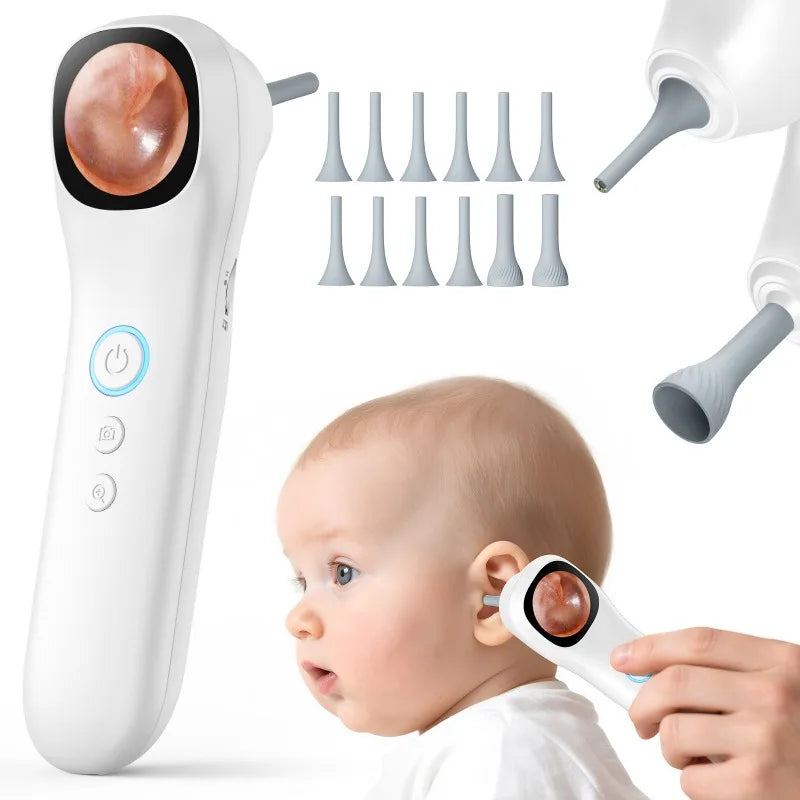 1.38'' Ear Camera Wit IPS Display and 1080P Camera Ear Check Portable Inspector for Ear Mouth Pet With 12tips Replaceable Tools Peaceful Pleasures Health and Wellness White C
