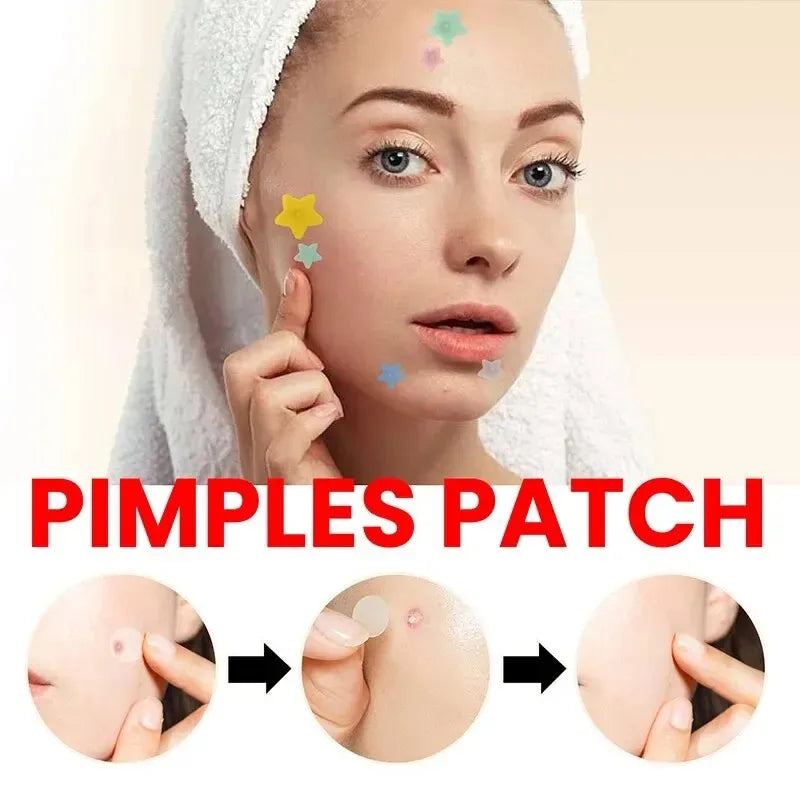 200pcs Acne Pimple Repair Patches | Fade Blemishes & Cover Spots