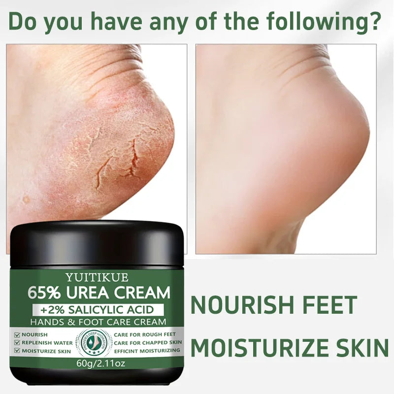 YUlTlKUE 65% Urea Cream +2% salicylic Acid Hands & Foot Care Cream Moisturize Rough chapped skin Nourish Hydrate 60g Peaceful Pleasures Health and Wellness