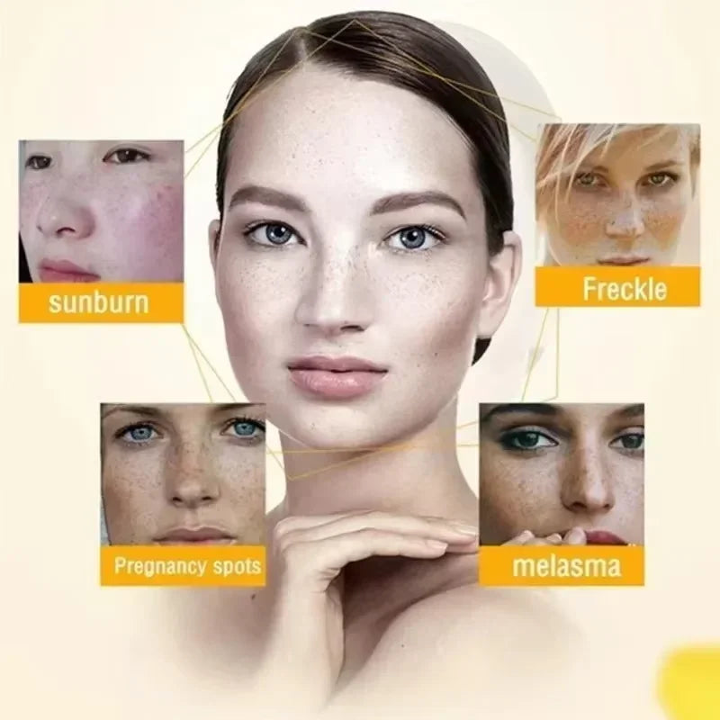 Niacinamide Brightening Cream – Fade Dark Spots 30g
