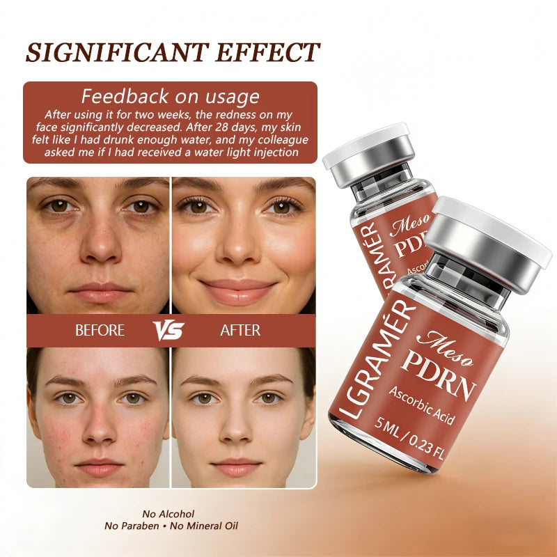 PDRN Salmon DNA Serum Vitamin C Brightening Korean Skincare 5ml Brightening Facial Serum Peaceful Pleasures Health and Wellness