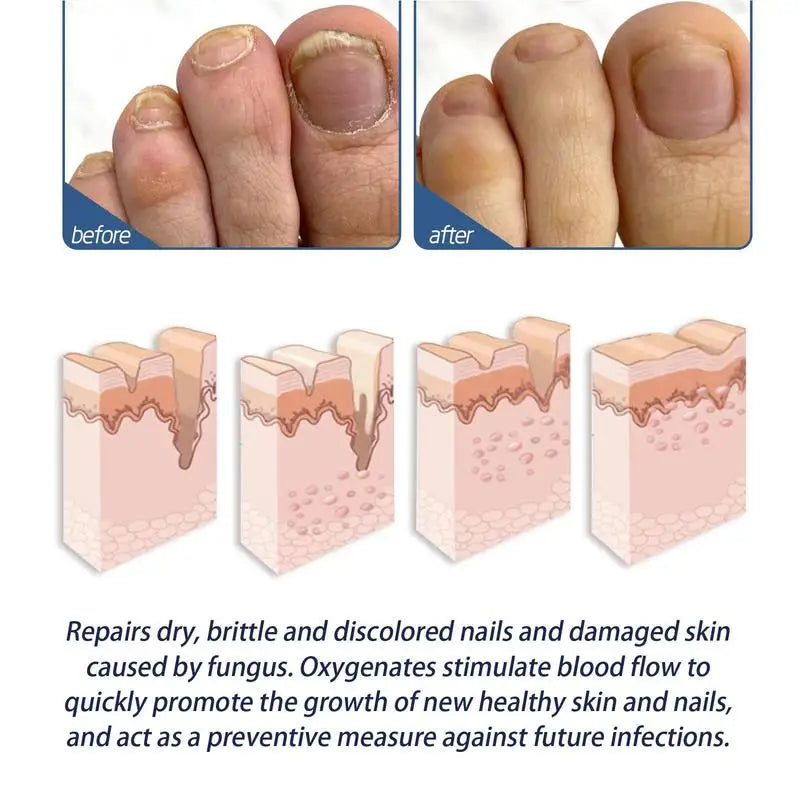Foot Peeling Spray – Callus & Dead Skin Remover for Soft Heels