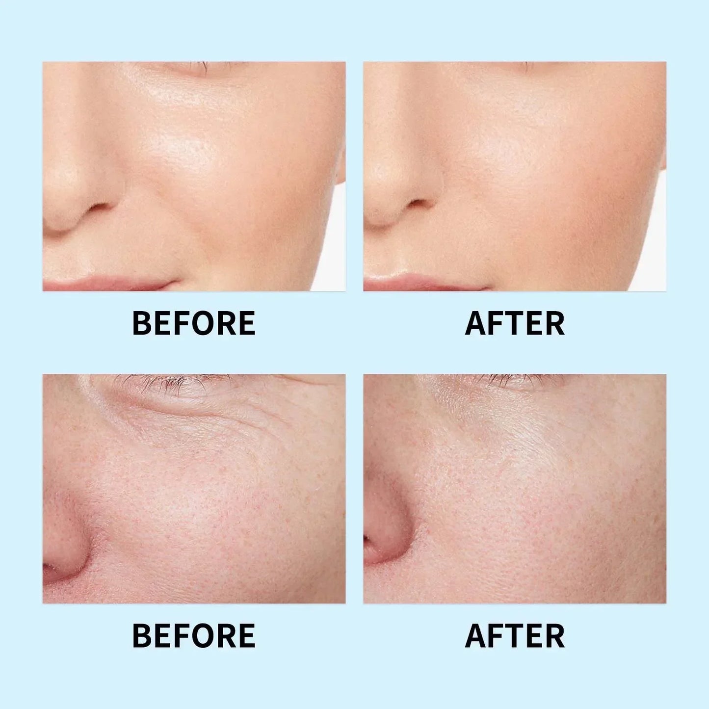 Hyaluronic Acid Face Serum – 3D Moisturizing Lifting Essence