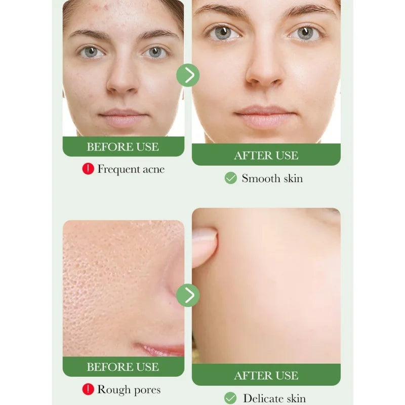 BIOAOUA Nourishing Centella Asiatica Facial Cleanser for Deep Pore Cleansing and Soothing Skin Care 100g Peaceful Pleasures Health and Wellness