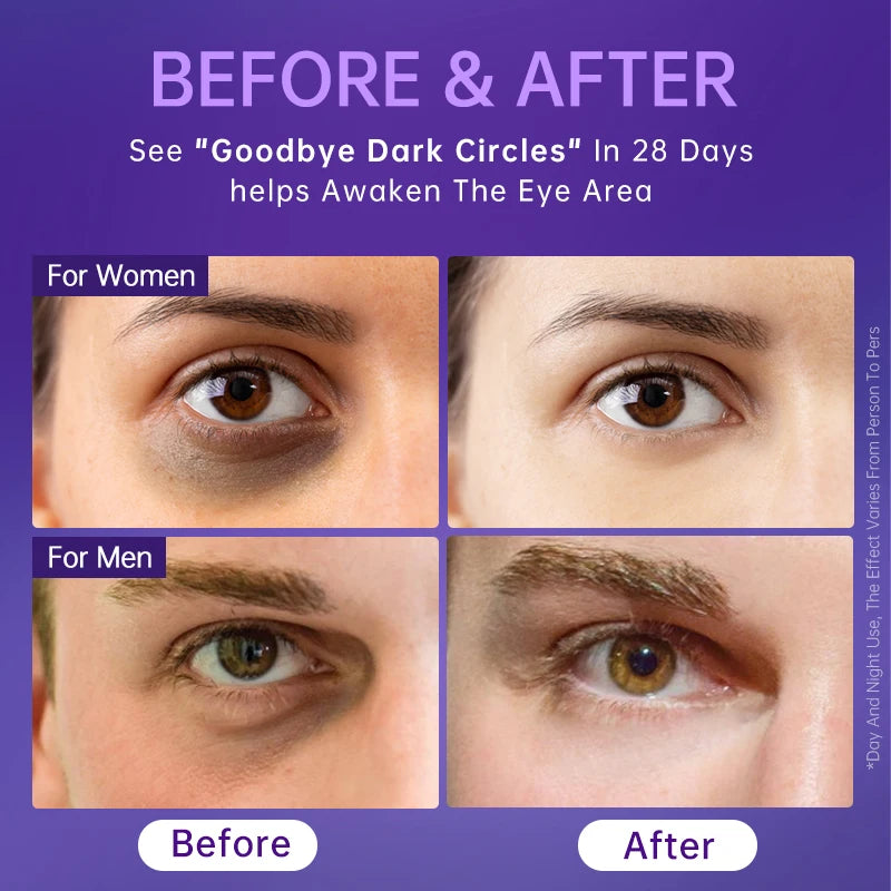 AUQUEST Niacinamide Eye Cream for Dark Circles & Eye Bags
