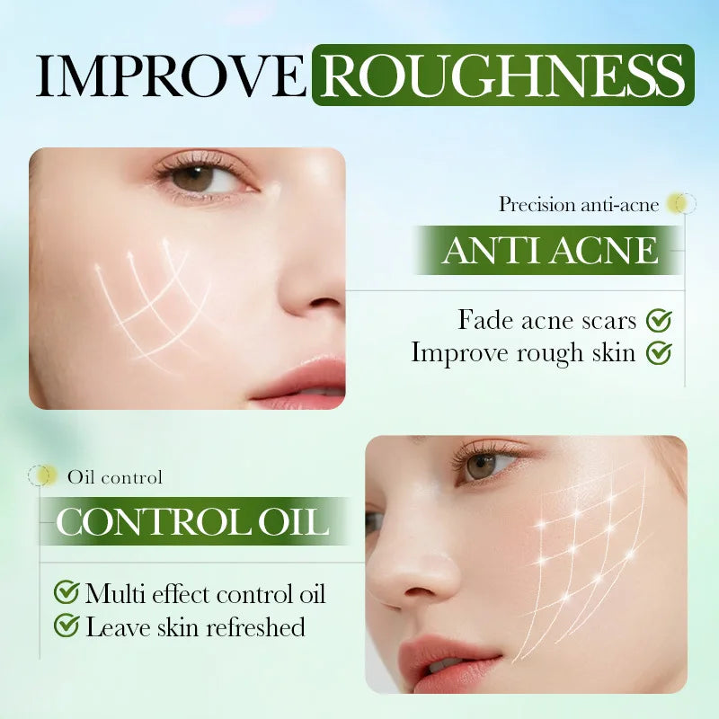 SADOER Salicylic Acid Face Cream – Oil Control & Clear Pores