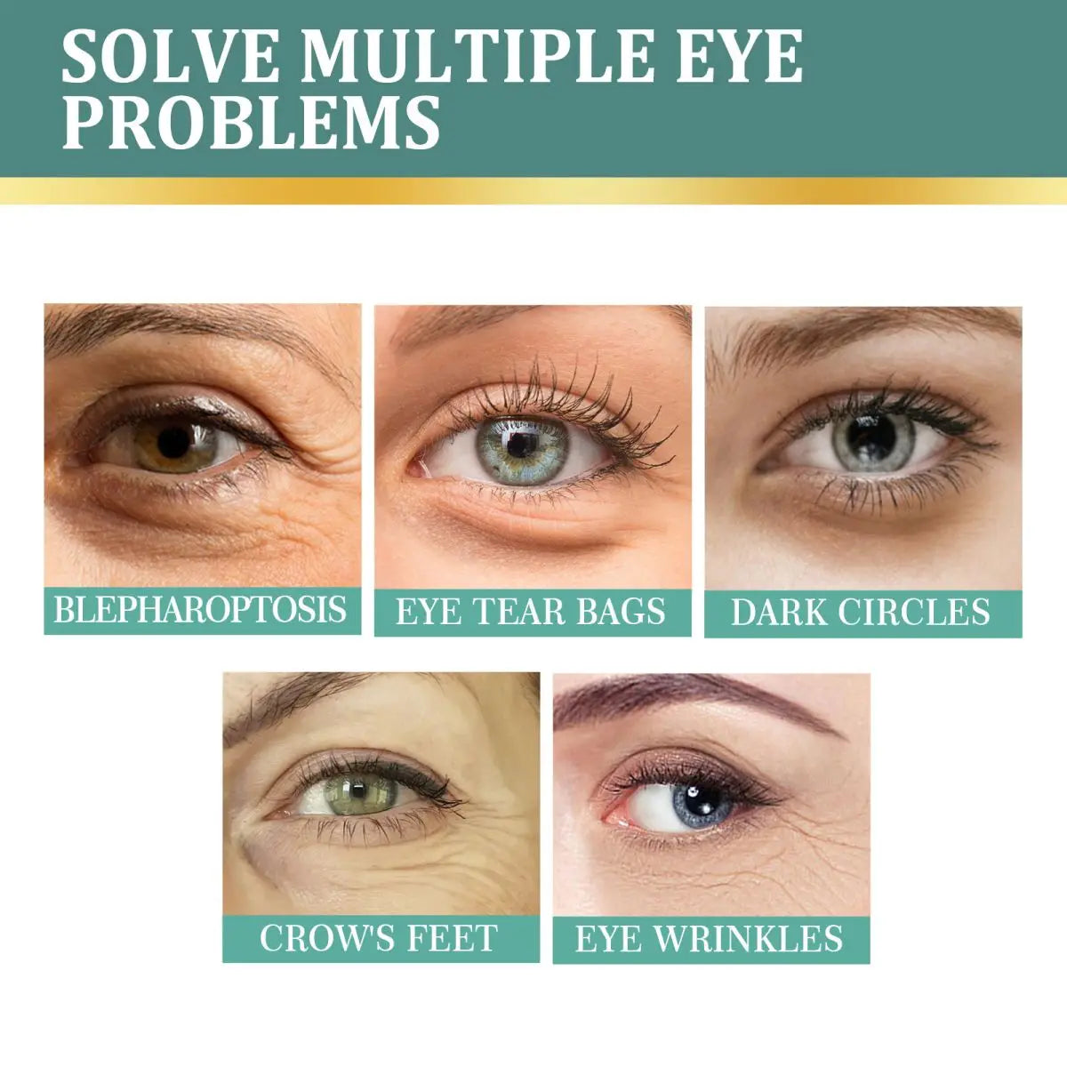 TRSTAY Eye Massage Oil – Moisturizing Essential Oil for Eyes