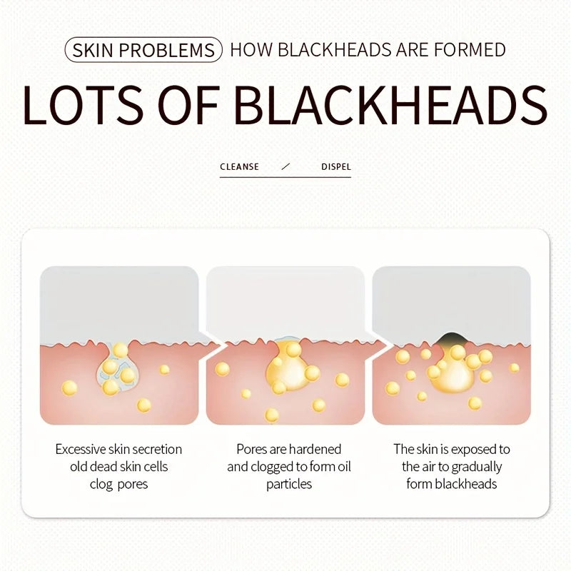 Three-Step Blackhead Removal Nose Patch Softens and Cleans Blackheads, Refines Pores, Nose Mask Patch Peaceful Pleasures Health and Wellness