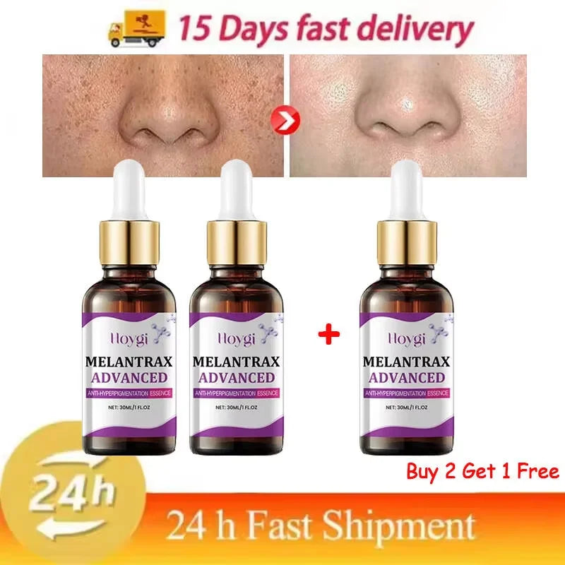 Hoygi Niacinamide Vitamin B3 Face Serum – Glow & Dark Spot Corrector