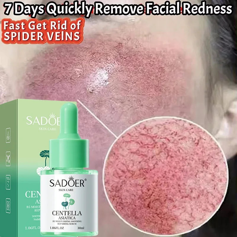 Facial Redness Repair Serum | Rosacea & Sensitive Skin Relief