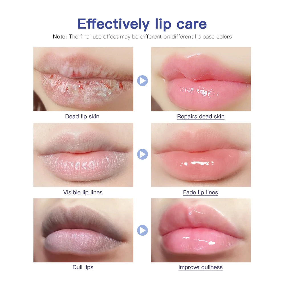 Hose Lip Care Repair Gel Cream Hydrating Hydrating Hydrating Hydrating Dryness Soothing Chapping Hydrating Repair Lip Balm Peaceful Pleasures Health and Wellness