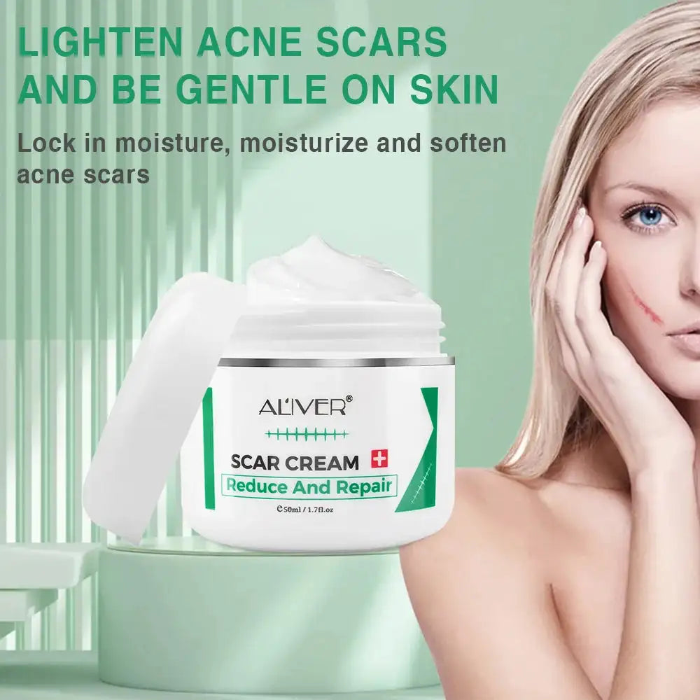 ALVER Acne Scar & Stretch Mark Remover Cream – 50ml Peaceful Pleasures Health and Wellness