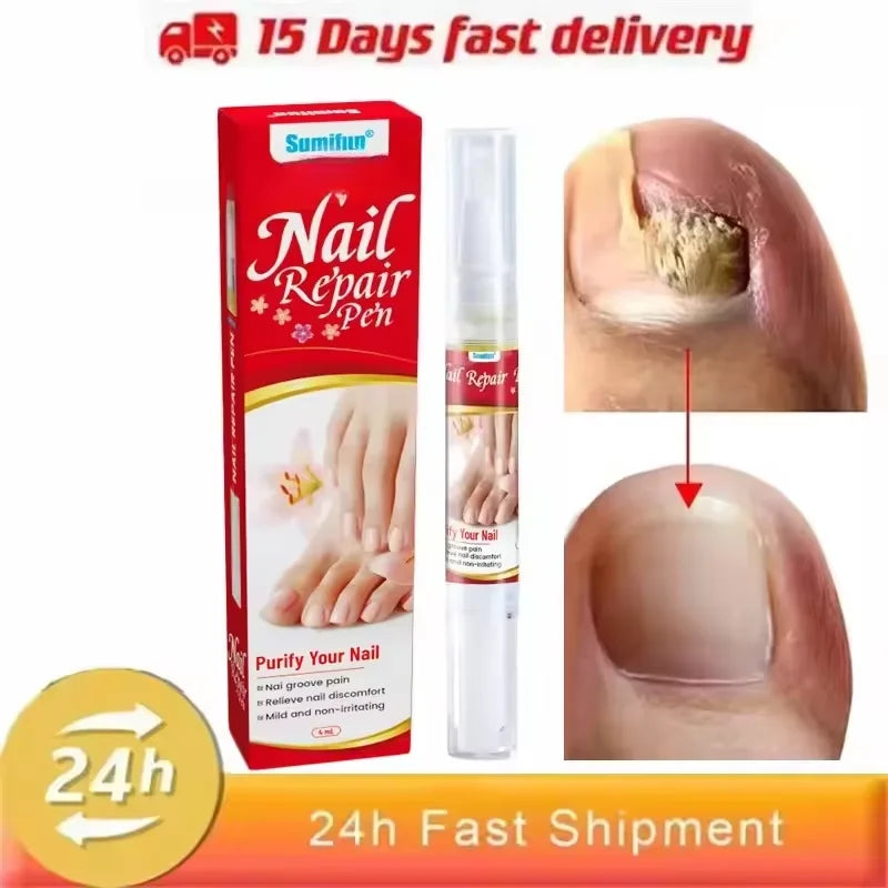 Fungal Nail Treatment Serum Foot Nail Fungus Removal Repair Gel Anti Infection Paronychia Onychomycosis Foot Nails Care Essence Peaceful Pleasures Health and Wellness Only 1 pcs