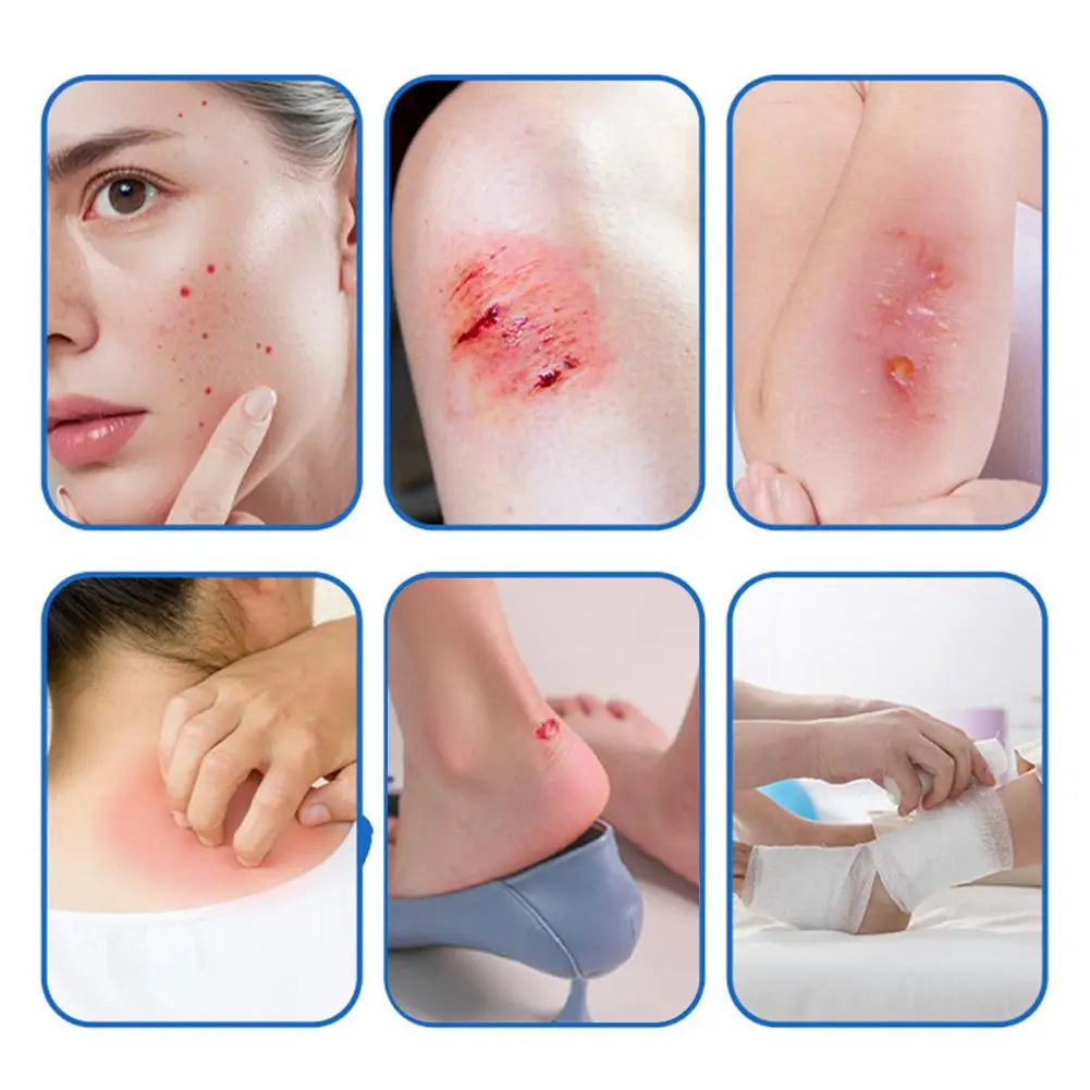 Hydrocolloid Bandage Roll – Waterproof Cut-to-Size Dressing