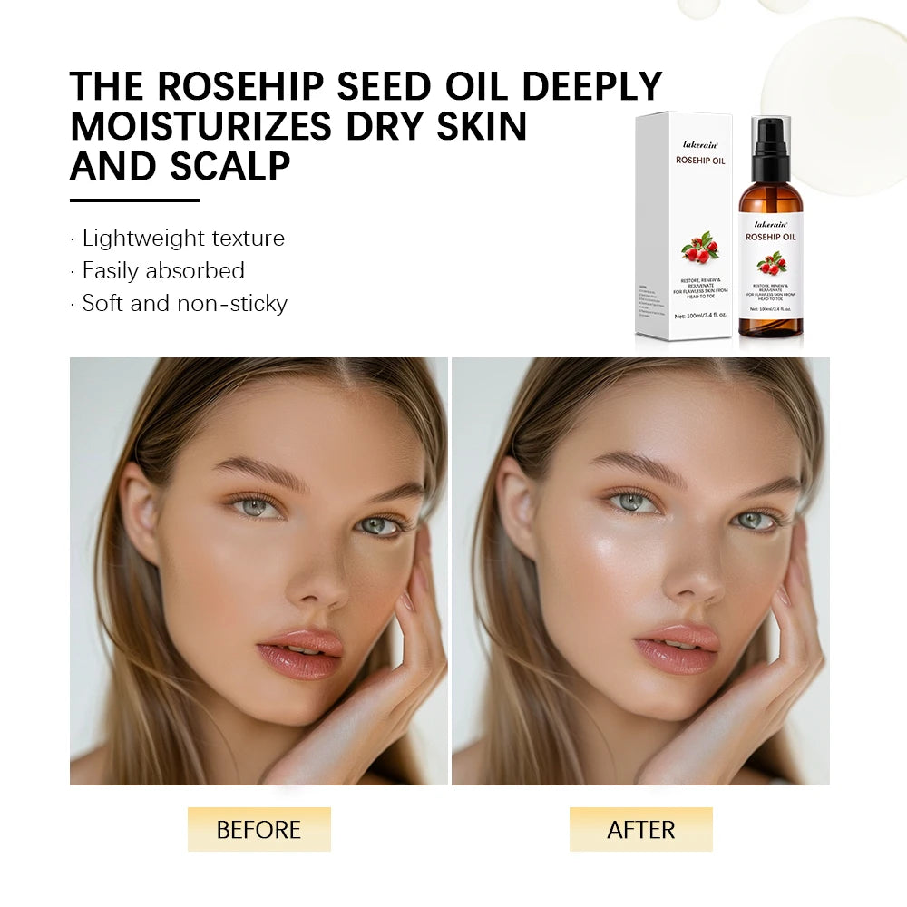 Organic Rosehip Oil Rose Hips Face Oils 30ml Fast-Absorbing Skin Care Moisturizer Face Oil Organic Rosehip Seed Oil Essence Peaceful Pleasures Health and Wellness