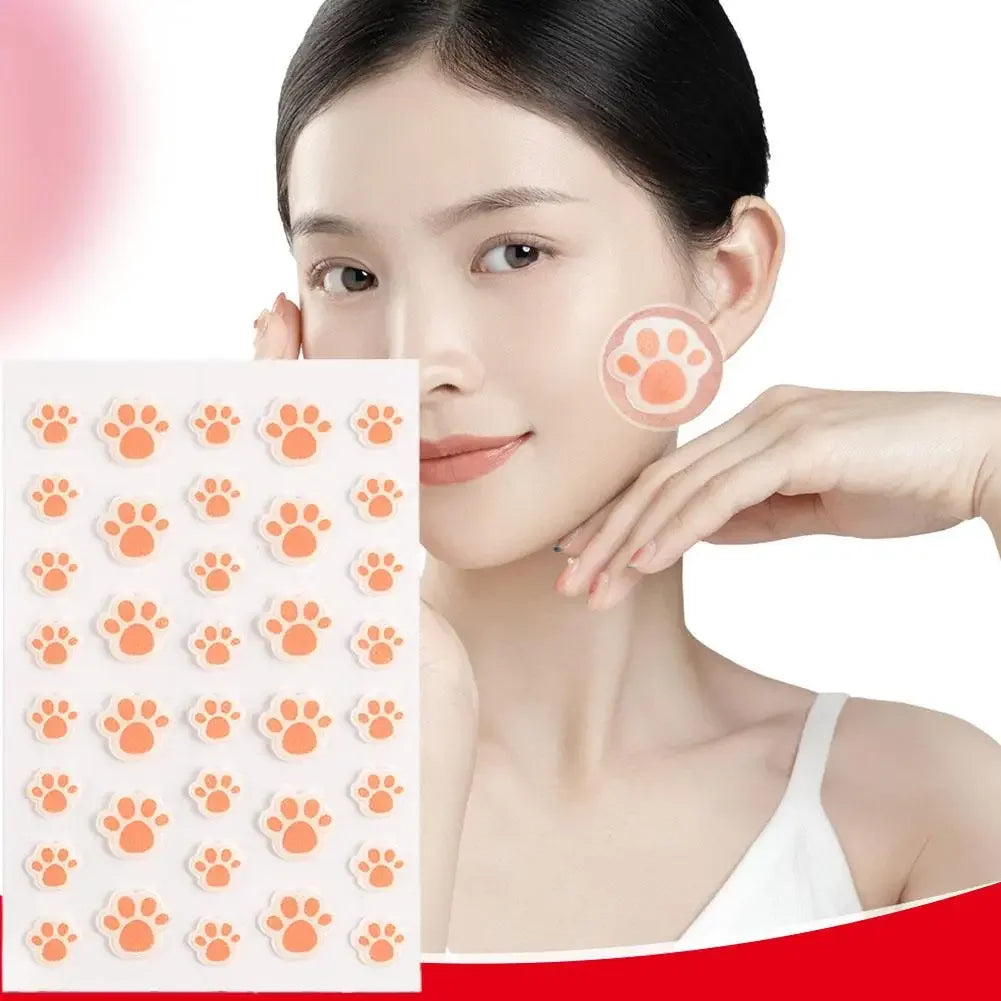36 Counts Cat Paws Hydrocolloid Acne Pimple Patch Cute Acne Care Cover Patch, Invisible Acne Zit Patches For Face Dots Blemish Peaceful Pleasures Health and Wellness