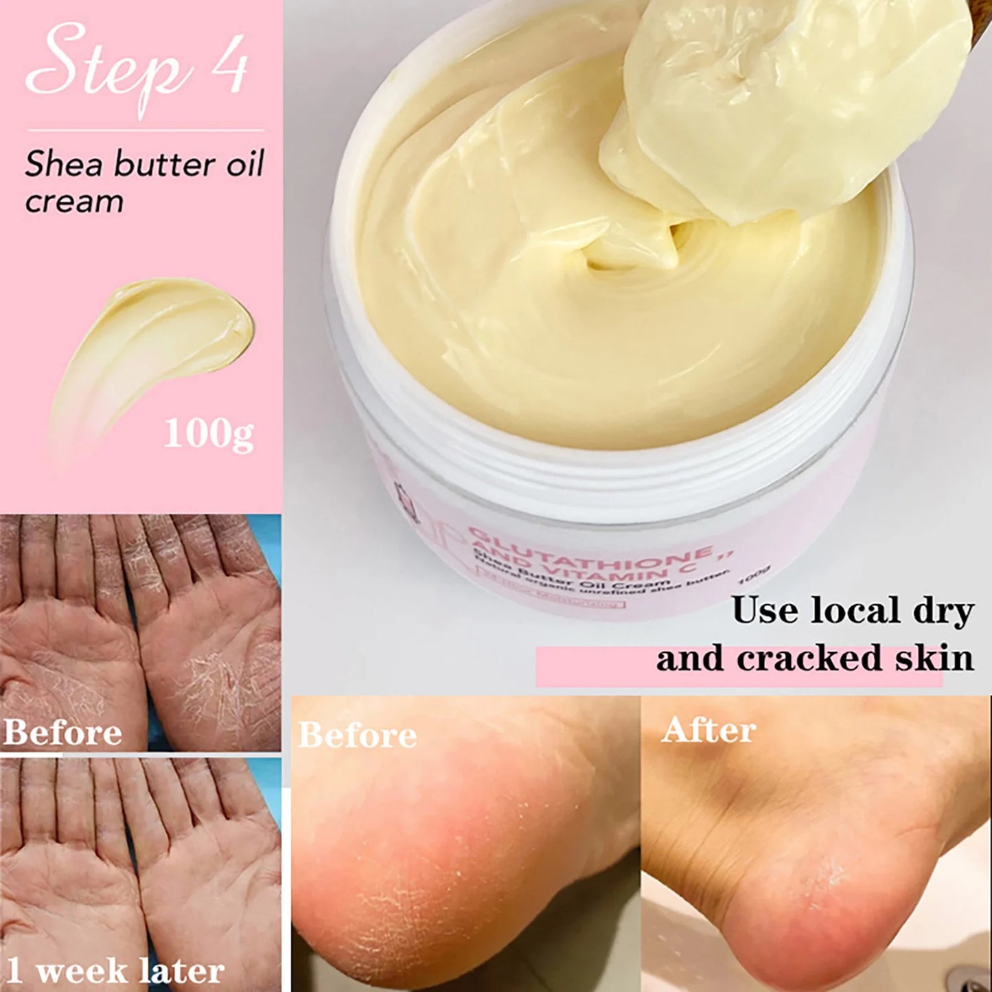 AILKE Glutathione & Vitamin C Shea Butter Cream 100ml