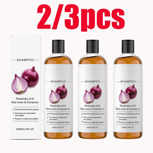 2/3pcs Rosemary Red Onion Shampoo Anti Hair Loss Promote Thicker Stronger excalvo Shampoo Hair Care 200ml Peaceful Pleasures Health and Wellness