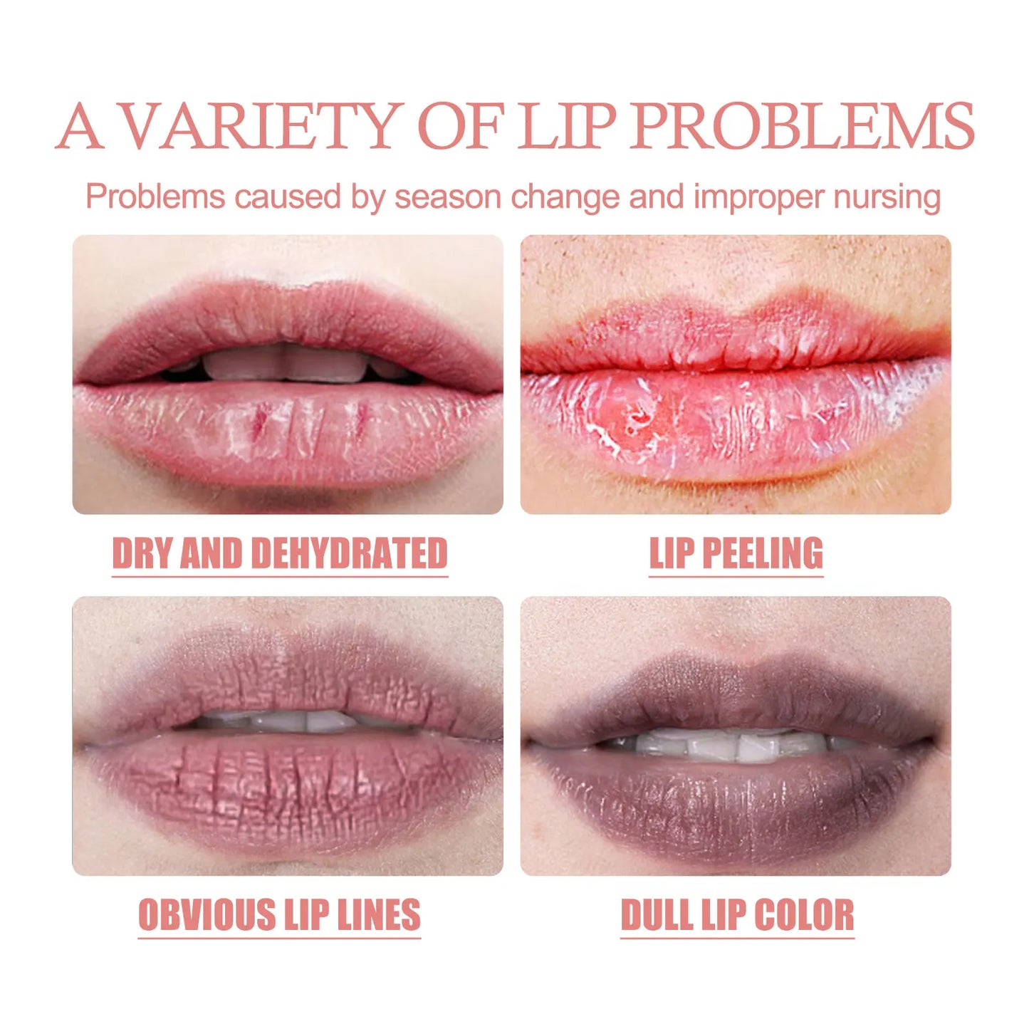 30ml Shea Butter Lip Exfoliating Mask – Moisturize & Smooth