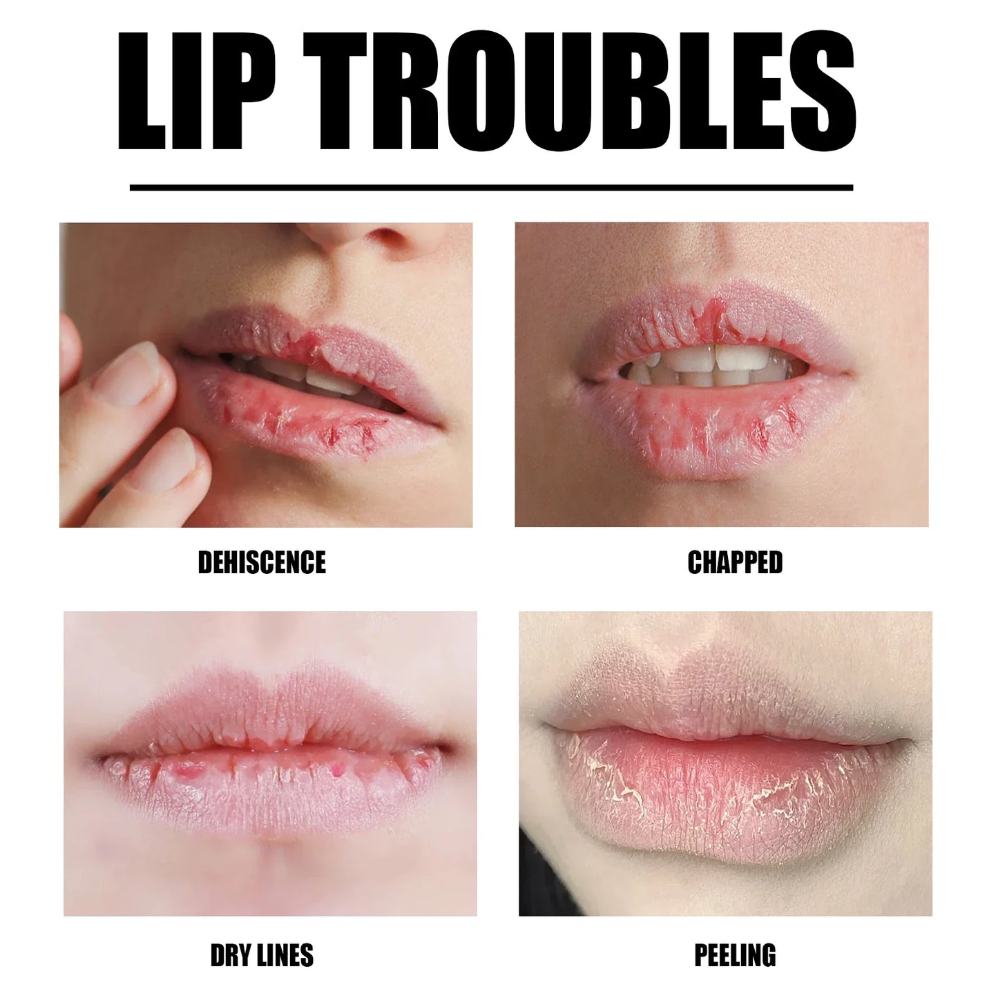 Strawberry Lip Scrub Cream – Exfoliate & Moisturize Lips 20g