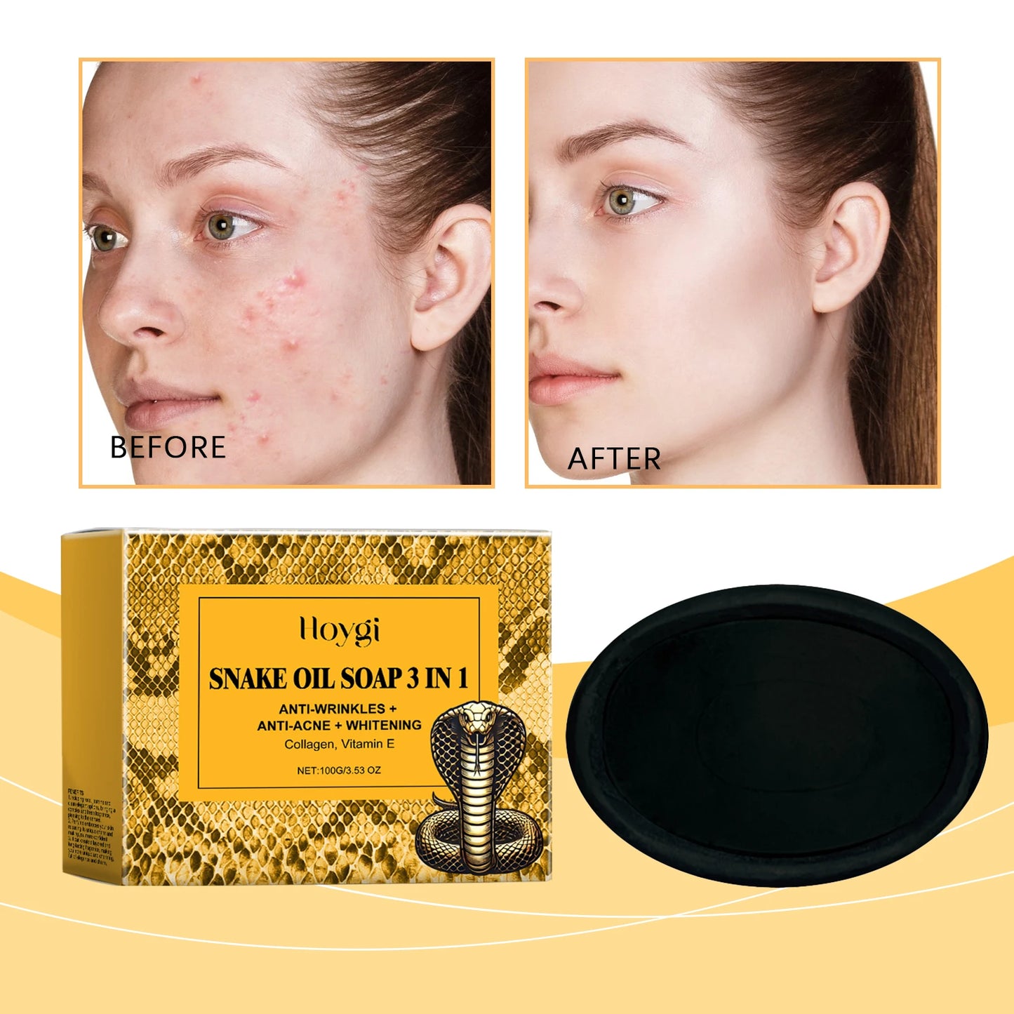 Hoygi Snake Oil Facial Cleansing Soap 100g – Oil Control & Soft Skin