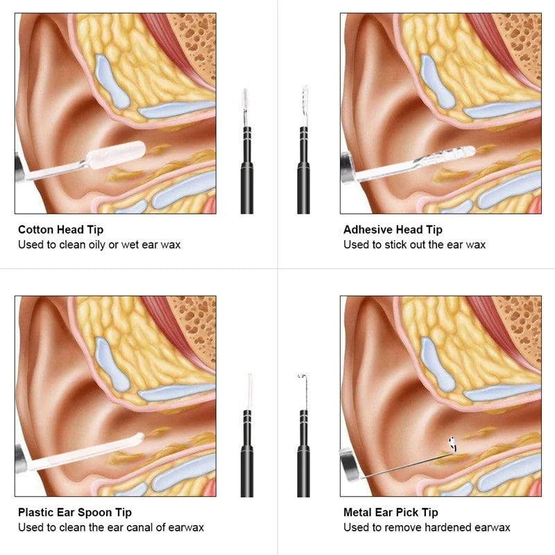 Visible Earpick Medical Otoscope Waterproof Camera Earwax Visual Oral Inspection Ear Spoon Support Android PC Ear Cleaning Tool Peaceful Pleasures Health and Wellness