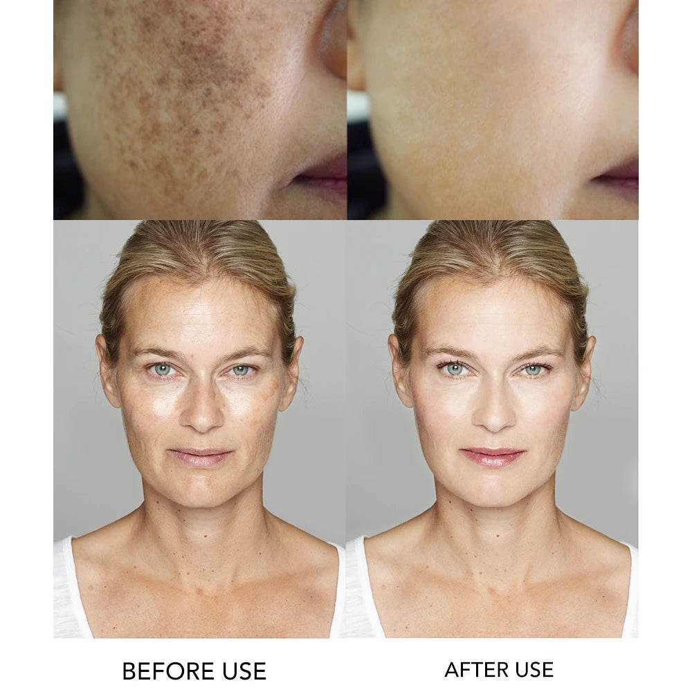 AILKE Whitening Facial Serum | Hyaluronic Acid & Vitamin B3