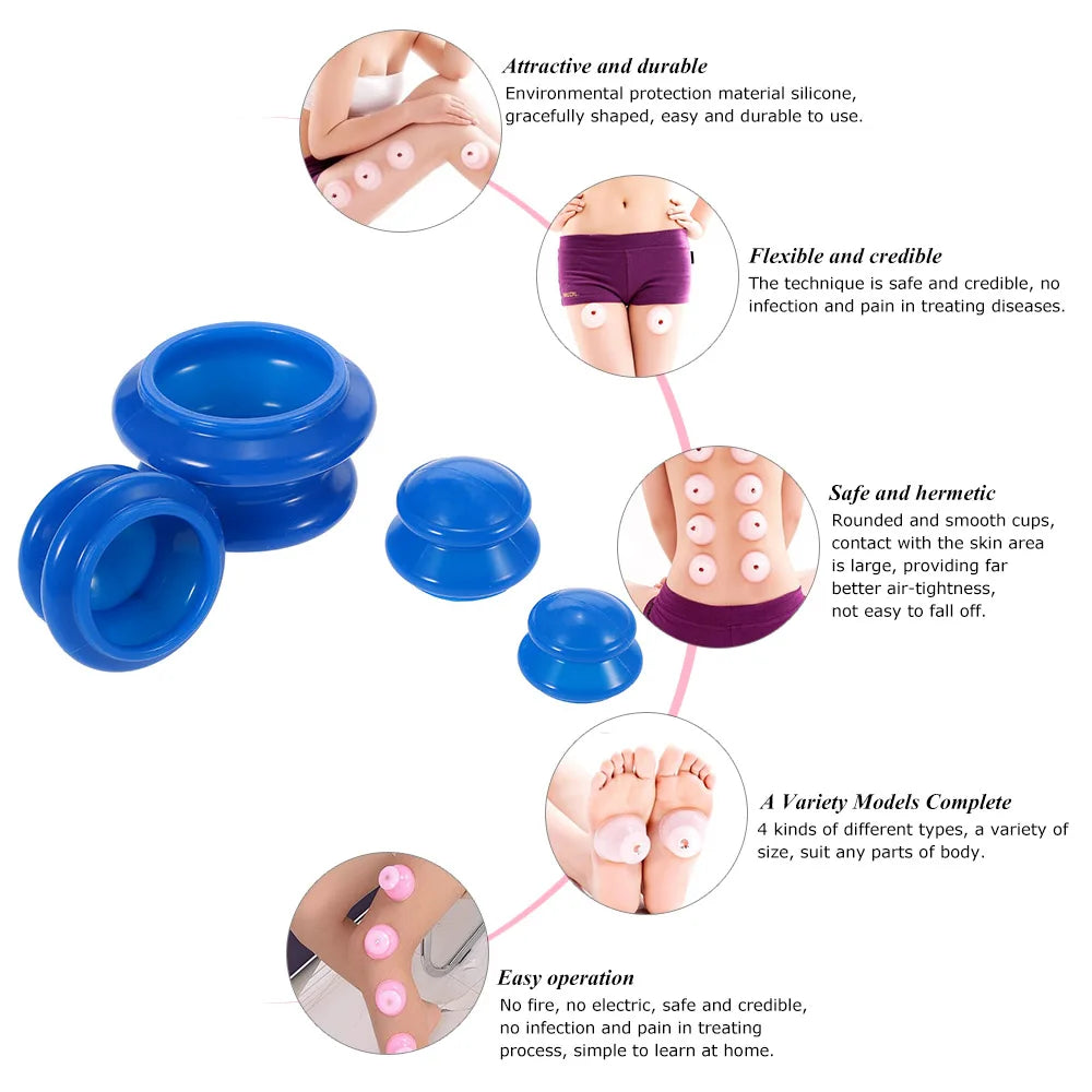 4-Piece Silicone Cupping Set – Anti-Cellulite Body Massage