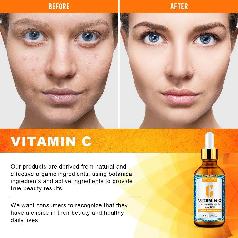 ENVISHA Face Serum – Vitamin C, Retinol & Hyaluronic Acid Face Serum ENVISHA