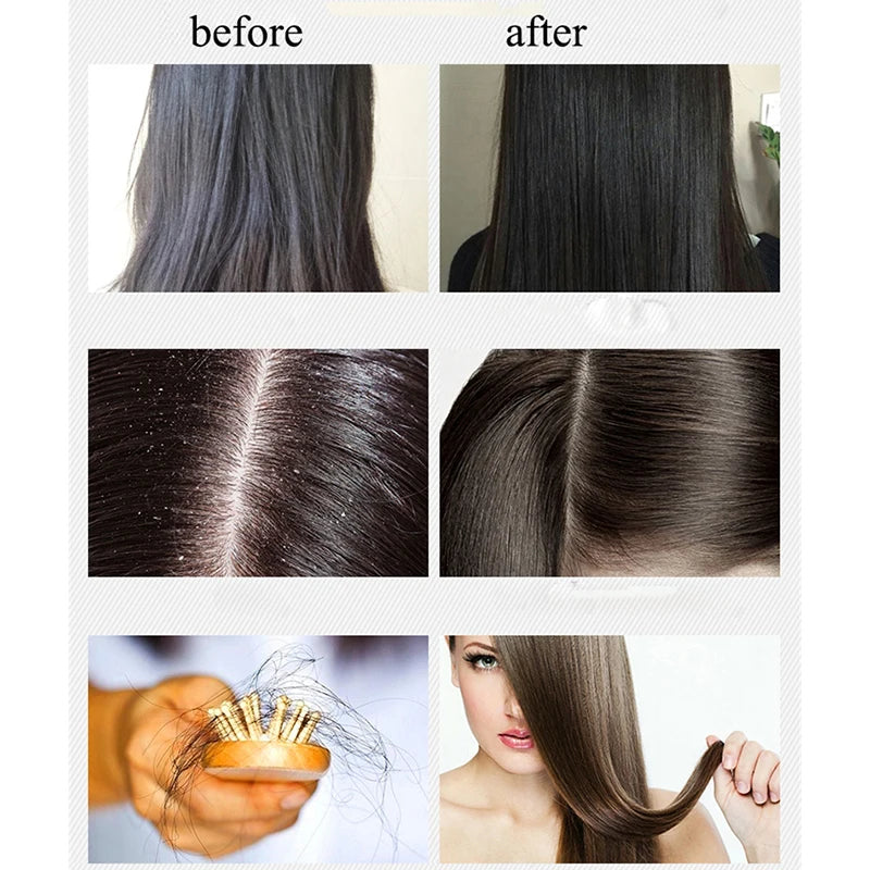 BOQIAN Professional Ginger Hair Shampoo 500ml Hair Conditioner Treatment 500ml Hair Care Set Moisturizing Clean Anti Hair Loss Peaceful Pleasures Health and Wellness