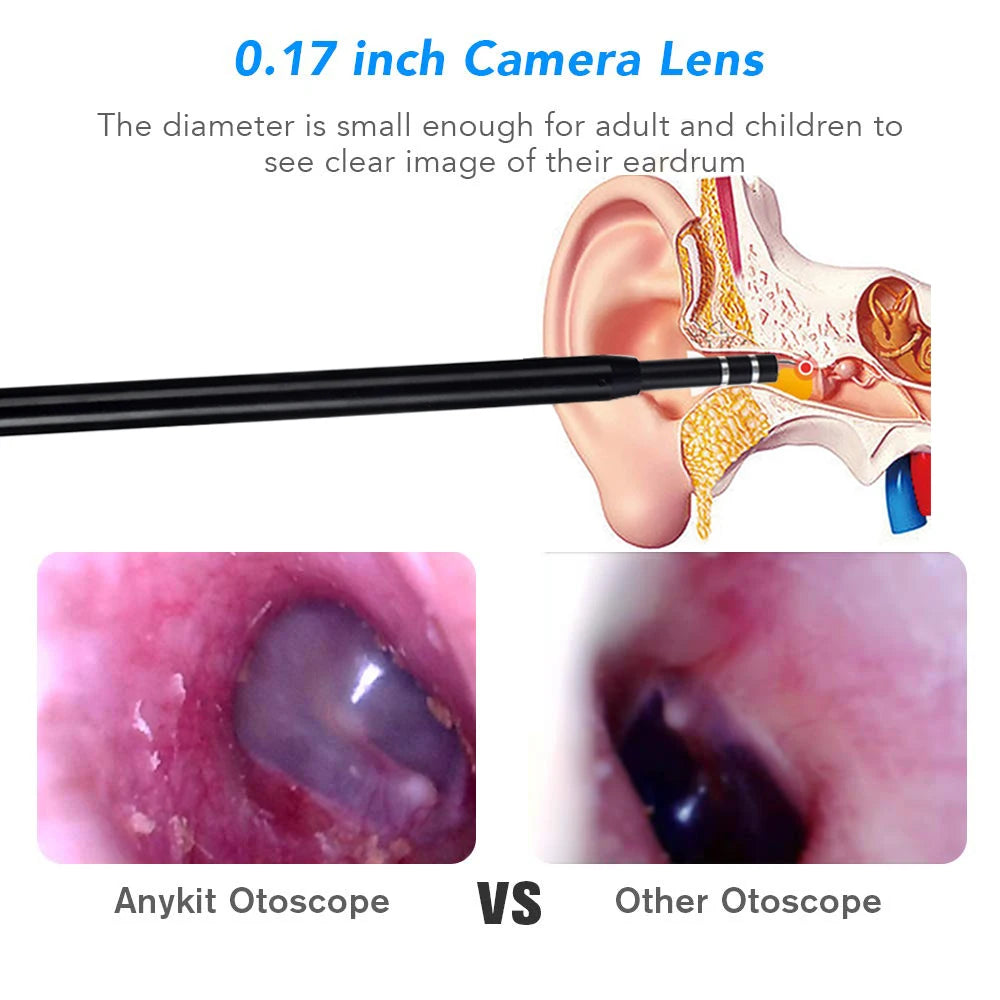 Visible Earpick Medical Otoscope Waterproof Camera Earwax Visual Oral Inspection Ear Spoon Support Android PC Ear Cleaning Tool Peaceful Pleasures Health and Wellness