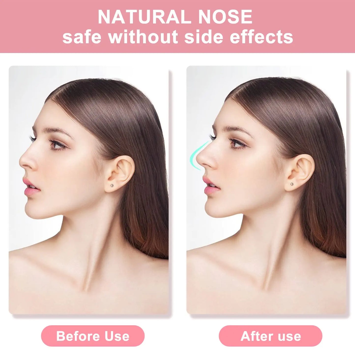 Nose Shaper Lifting Clips – 2 Sets, 3 Sizes | Silicone & Acrylic
