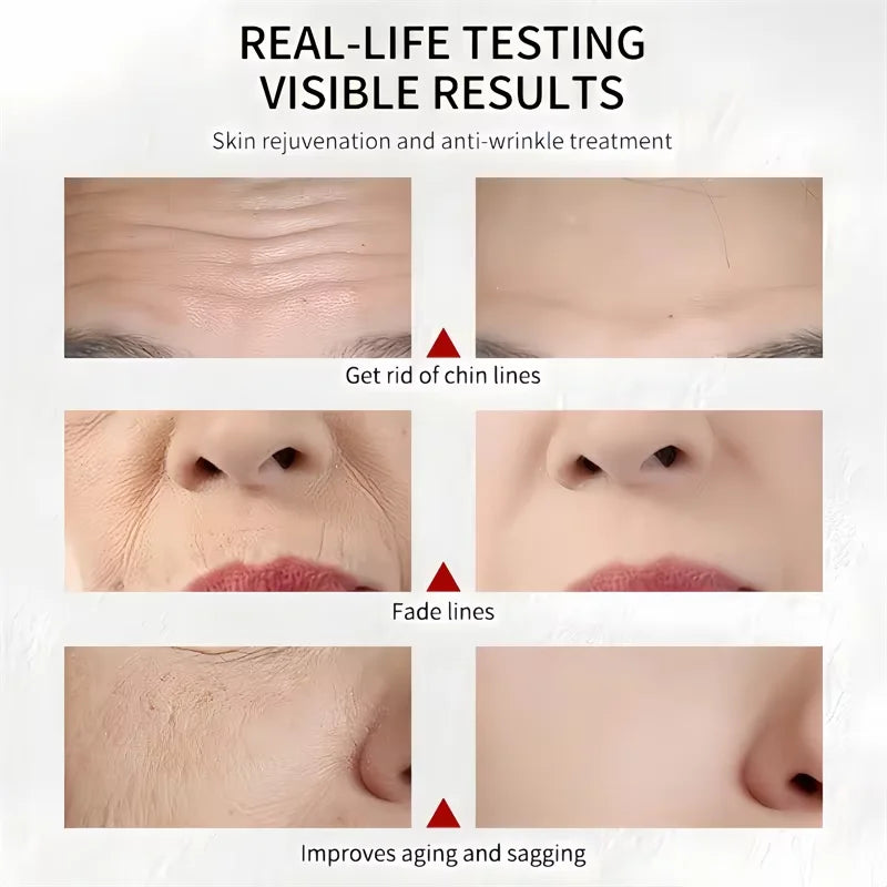 30g Retinol Wrinkle Removal Cream Fade Face Eye Fine Line Instant Anti Aging Whitening Anti-Wrinkle Dark Circles Dismiss Cream Peaceful Pleasures Health and Wellness
