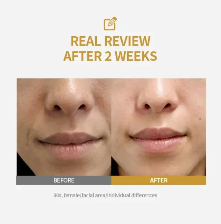 Kojic Acid & Niacinamide Brightening Serum | Dark Spot Corrector
