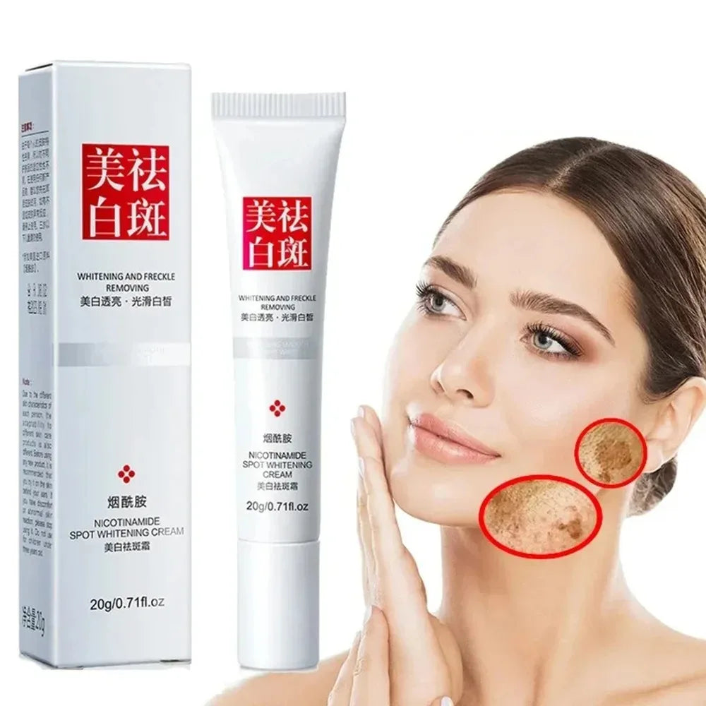 1/3/5pcs Fades Freckle Dark Spots Face Cream Niacinamide Whitening Cream Vitamin E Improve Dullness Fast Brighten Nourish Skin Peaceful Pleasures Health and Wellness