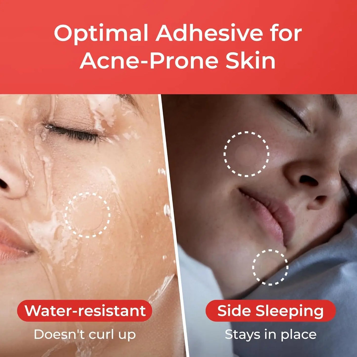 1200 Pieces/Set Hydrogel Acne Coverage Patches: Non-Irritating Skin Care for All Skin Types (Unisex) Peaceful Pleasures Health and Wellness